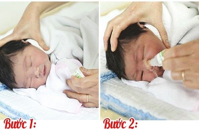 Hướng dẫn các mẹ bí quyết điều trị khi trẻ sơ sinh bị đàm nhớt